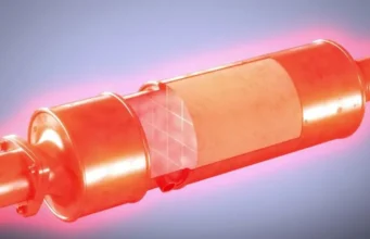 Anulare Filtru de Particule DPF: Avantaje și Riscuri anulare-filtru-de-particule